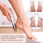 Electric foot grinder - Image 3